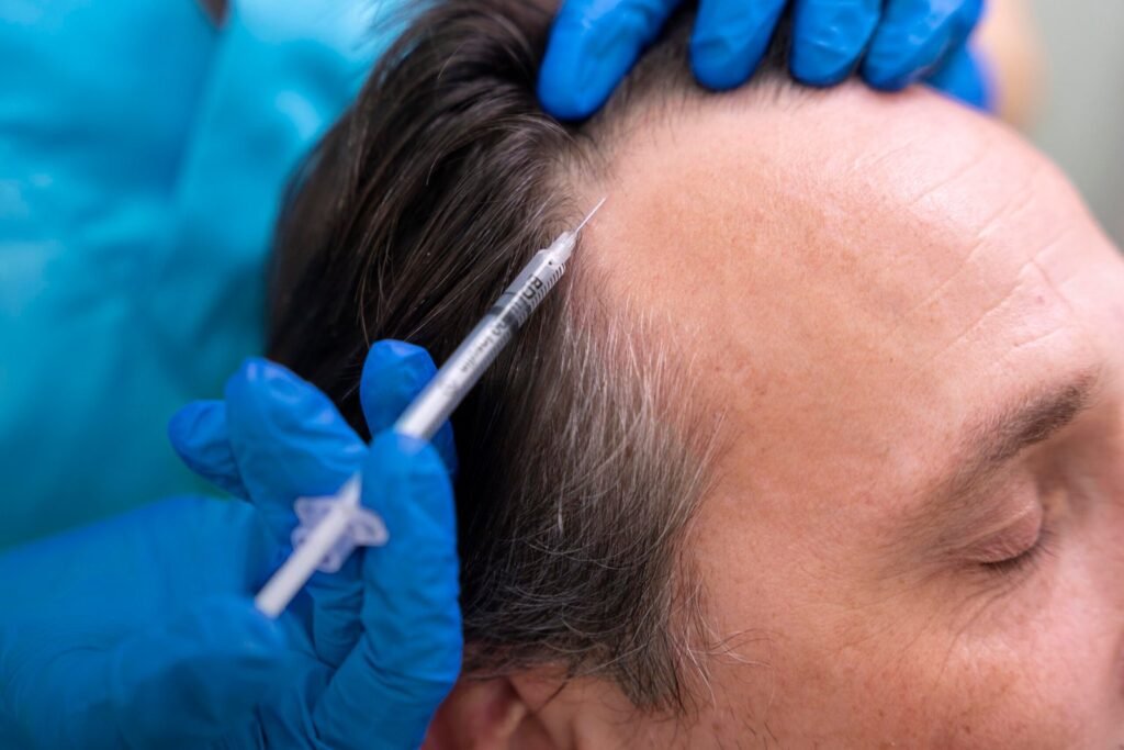 adult male getting hair loss treatment scaled.jpg